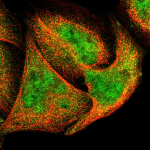 Anti-DCTPP1