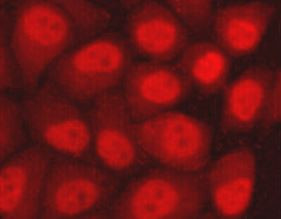 Anti-hHR23b, clone 5H1-A10-A7