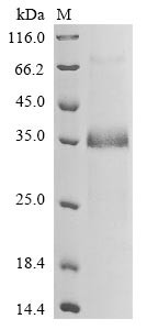 Notch homolog 2 N-terminal-like protein B (NOTCH2NLB), human, recombinant