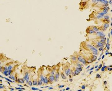 Anti-Calumenin