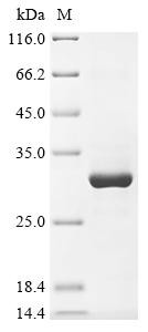 Transient receptor potential cation channel subfamily A member 1 (Trpa1), partial, rat, recombinant