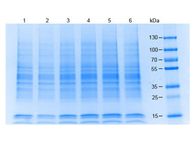 Raji Whole Cell Lysate