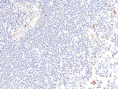 Anti-CD137 (4-1BB), Rabbit Monoclonal (RM471)