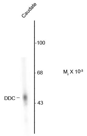 Anti-DOPA Decarboxylase
