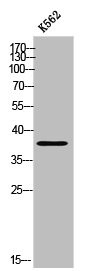Anti-TMEM30B
