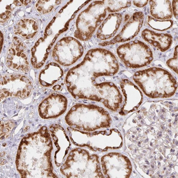 Anti-MRPL28