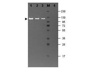 Anti-BETA GALACTOSIDASE (E.coli)