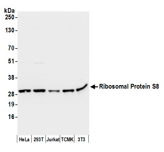 Anti-Ribosomal Protein S8/RPS8