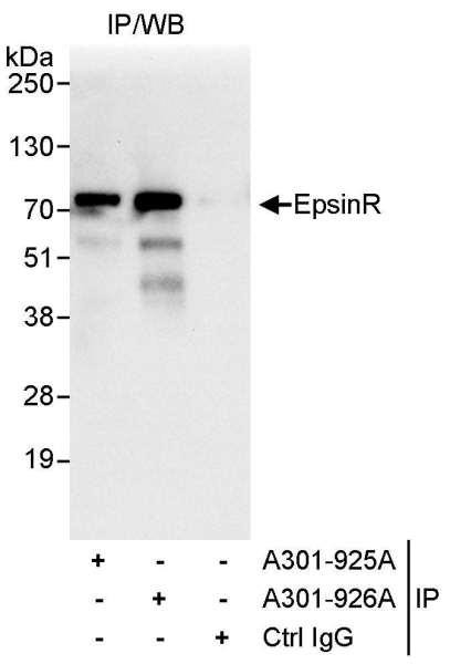 Anti-EpsinR