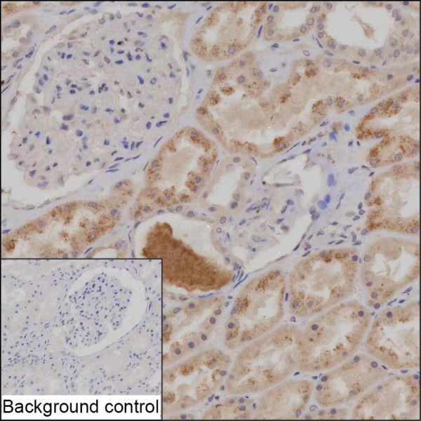 Anti-Interferon gamma