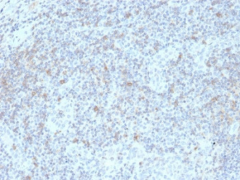 Anti-IL7R / CD127, clone IL7R/2751