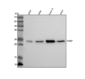 Anti-PUDP / Pseudouridine 5-phosphatase