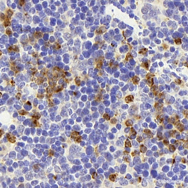 Anti-CD177