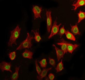 Anti-RTF2 / Replication termination factor 2