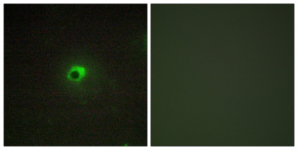 Anti-ACVR1C / ALK7