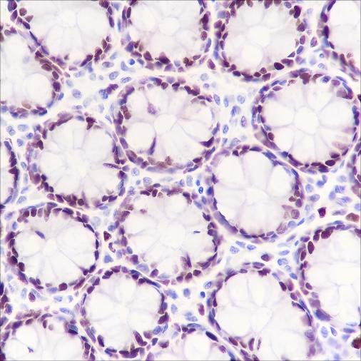 Anti-Recombinant MCM3, clone A296