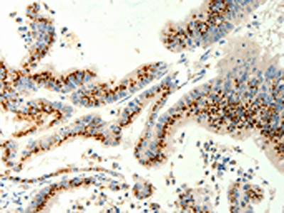 Anti-TRPC6