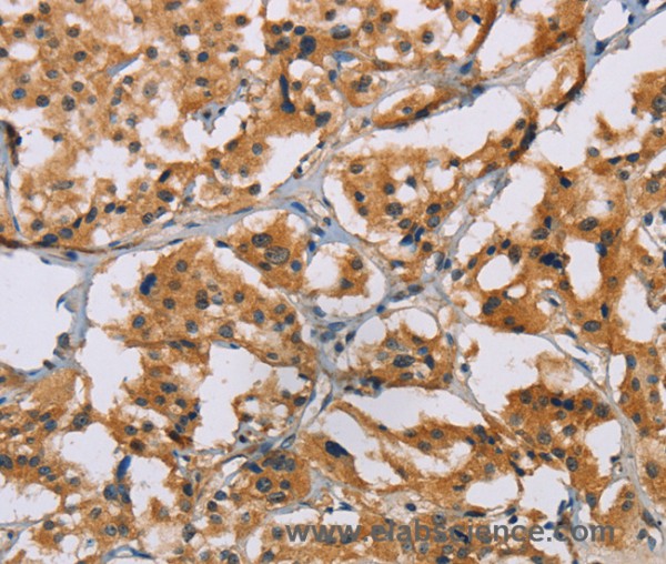 Anti-NRN1