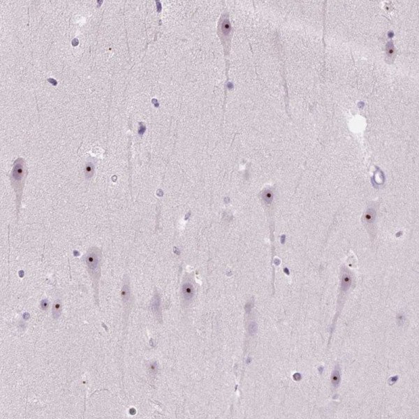 Anti-UTP4