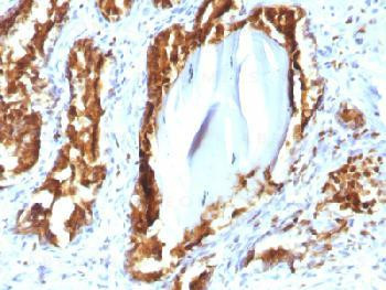 Anti-Prostate Specific Acid Phosphatase (PSAP) Recombinant Mouse Monoclonal Antibody (clone:rACPP/13