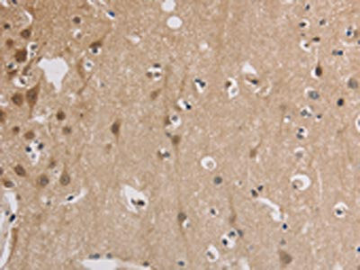 Anti-ELOVL1