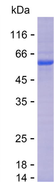 Recombinant Human AP4M1 Protein