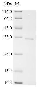 Regulator of G-protein signaling 16 (RGS16), recombinant human