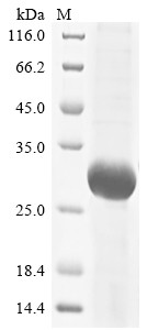 Granulocyte colony-stimulating factor receptor (CSF3R), partial, human, recombinant