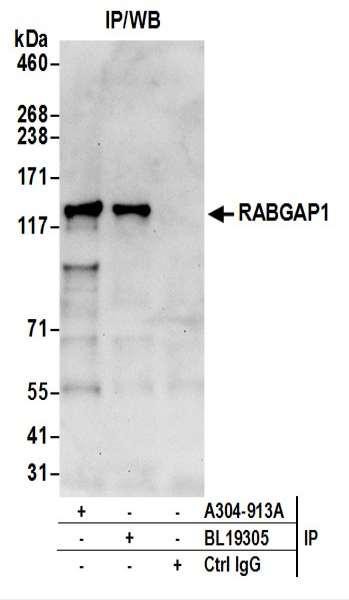 Anti-RABGAP1