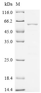 Serine/threonine-protein phosphatase PGAM5,mitochondrial (PGAM5), partial, human, recombinant