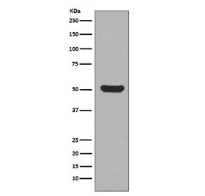 Anti-KRT16 / Cytokeratin 16, clone EDC-11