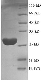 Elongation factor Tu, mitochondrial (TUFM), partial, recombinant human