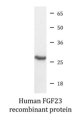 Human FGF23 recombinant protein (Active)