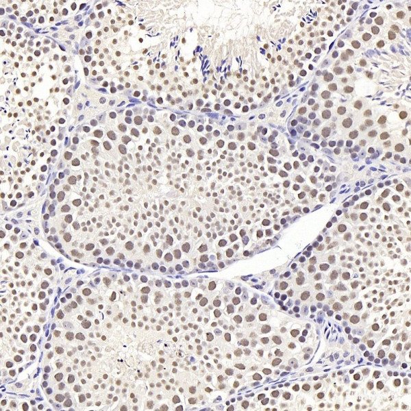 Anti-SIRT1