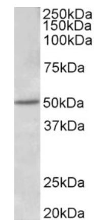 Anti-Estrogen Receptor beta