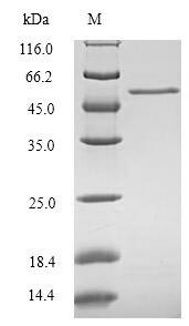 CCN family member 1 (CCN1), human, recombinant