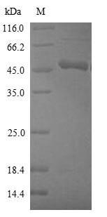 Cystathionine beta-synthase (CBS), partial, human, recombinant