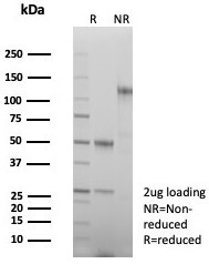 Anti-Beta-Parvin, clone PARVB/8214R