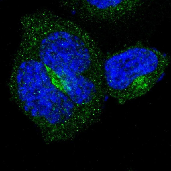 Anti-B4GALT3