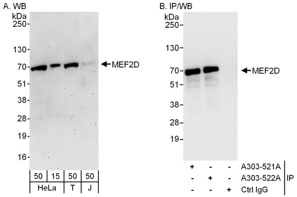 Anti-MEF2D