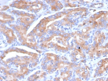 Anti-SI-CLP / CHID1 / Chitinase Domain Containing 1, clone CHID1/6368