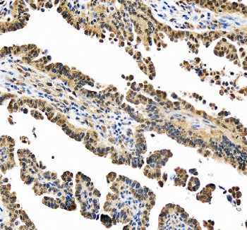 Anti-PSMC1 / 26S Proteasome regulatory subunit 4