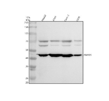Anti-SMYD5 / SET and MYND domain-containing protein 5