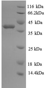 Glutaredoxin-1 (GLRX), human, recombinant
