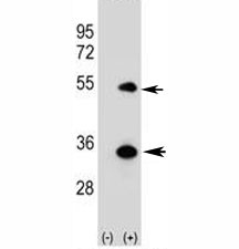 Anti-ATG5