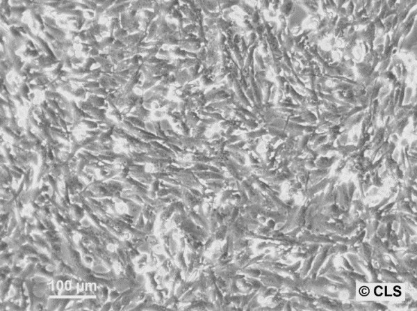 GCT Cells