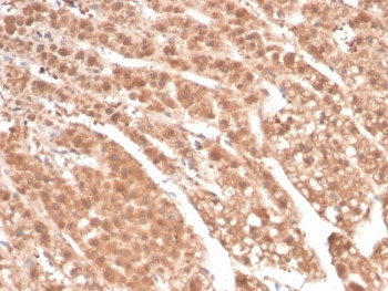 Anti-AKR1B1 / Aldose reductase, clone rAKR1B1/7295