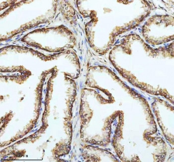 Anti-PIN4 / Peptidyl-prolyl cis-trans isomerase NIMA-interacting 4, clone 29P19