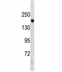 Anti-TSC1