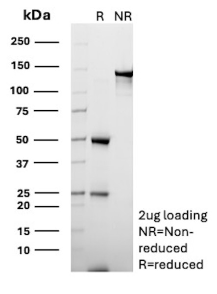 Anti-CD70 / TNFSF7 (Activated T- &amp; B-Lymphocyte Marker), clone BU69